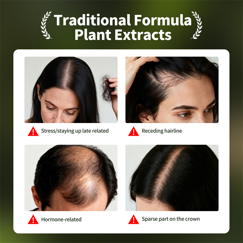 Set Perawatan Rambut Alami Usm - Epidermal Growth Factor ulasan dan harga