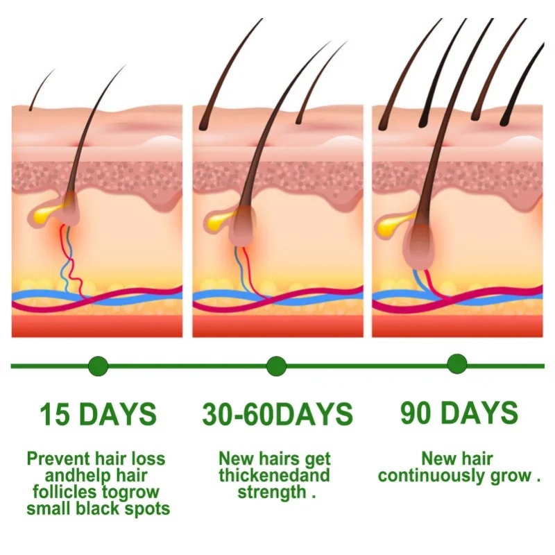 Serum Penumbuh Rambut Set Pera - Epidermal Growth Factor ulasan dan harga