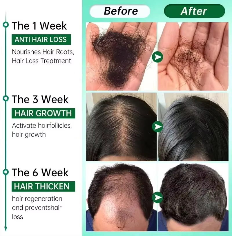 Serum Penumbuh Rambut 7 Hari P - Epidermal Growth Factor ulasan dan harga