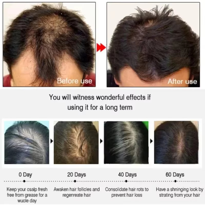 Serum Penumbuh Rambut 7 Hari P - Epidermal Growth Factor ulasan dan harga