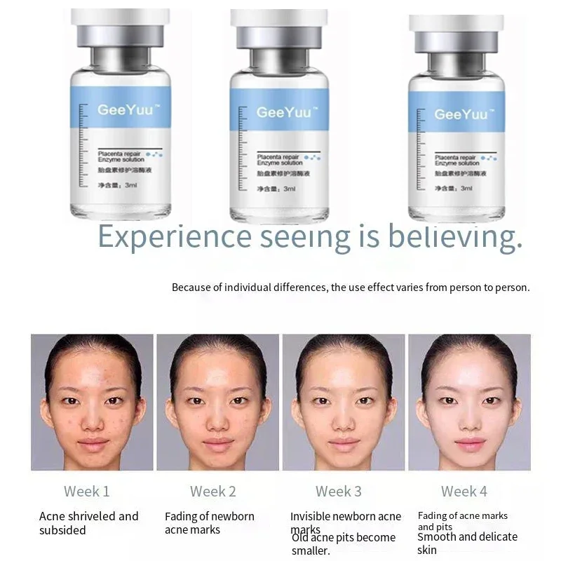 Polipeptida Plasenta Bubuk Ker - Epidermal Growth Factor ulasan dan harga