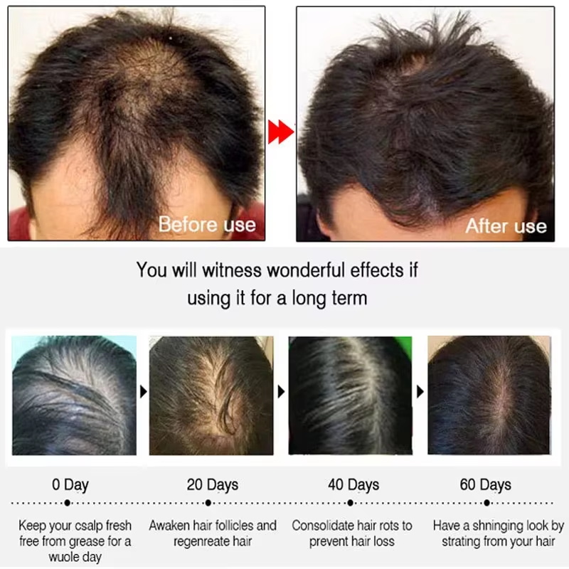 Semprotan Penumbuh Rambut Jahe - Epidermal Growth Factor ulasan dan harga